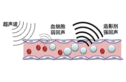 高压功率放大器在超声上的应用有哪些